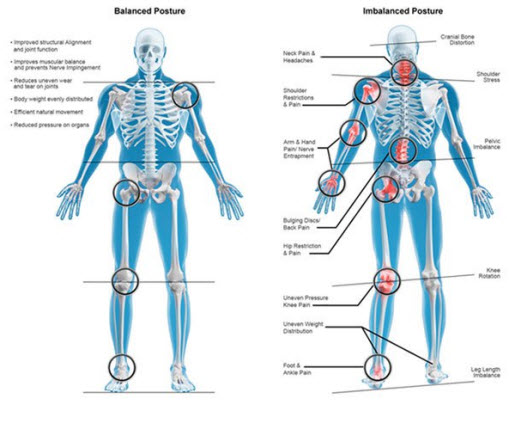 Body Alignment and Pain